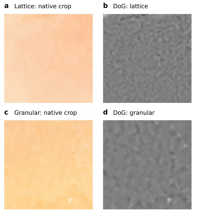 Native crops and difference-of-Gaussians (DoG) views of a lattice-positive candidate and a granular region.